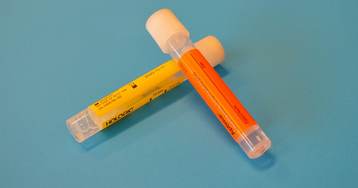 How to prepare for the 'HDL and LDL' test: rules for taking it