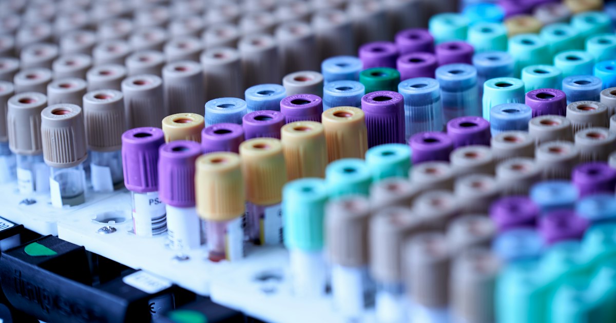 How to prepare for the 'Triglycerides' test: rules for taking it