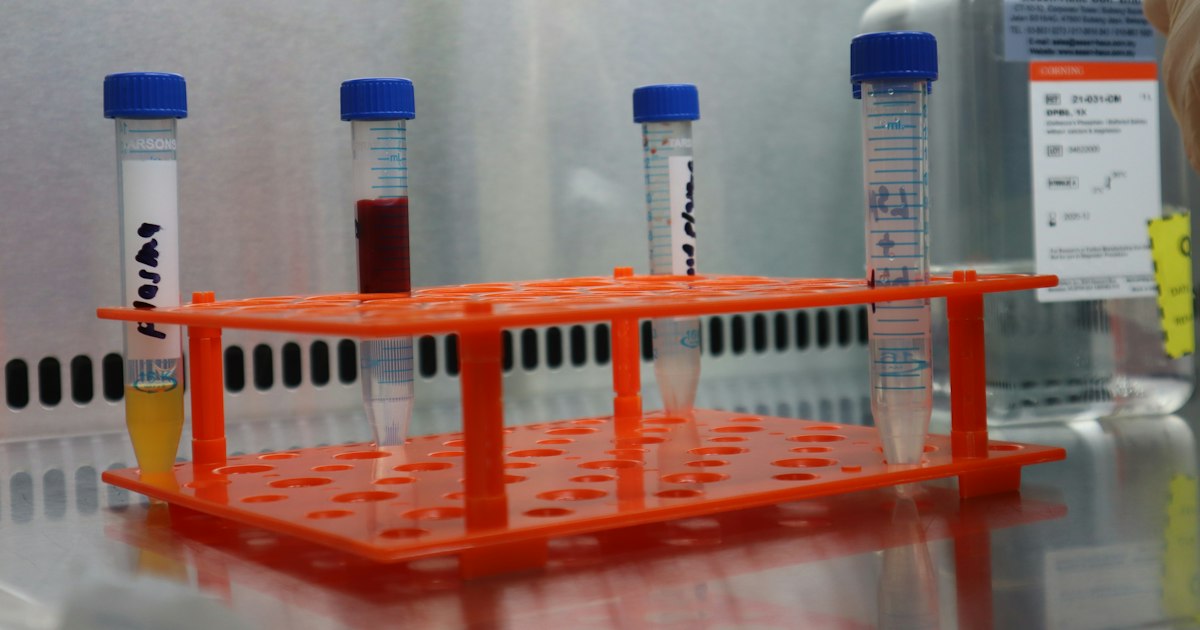 How to prepare for the 'Apolipoprotein B' test: rules for taking it