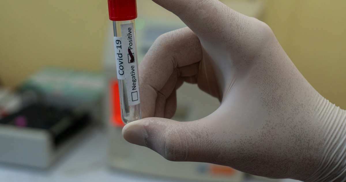 How to prepare for the 'Glycated hemoglobin (HbA1c)' test: rules for taking it